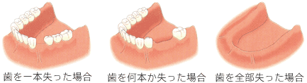 検査と治療計画